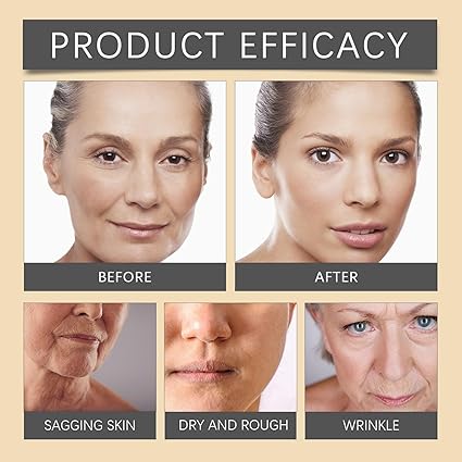 Bee Venom Botox Wrinkle Cream